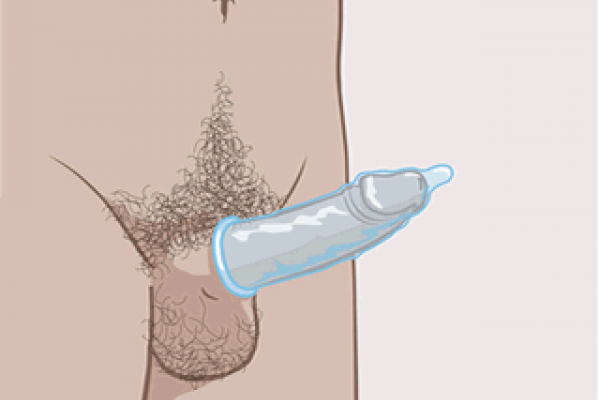 Afgerold condoom met rand aan de buitenkant