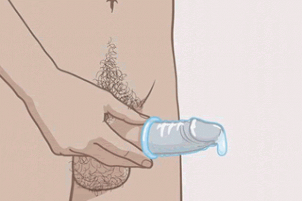 Voorzichtig verwijderen condoom van penis.