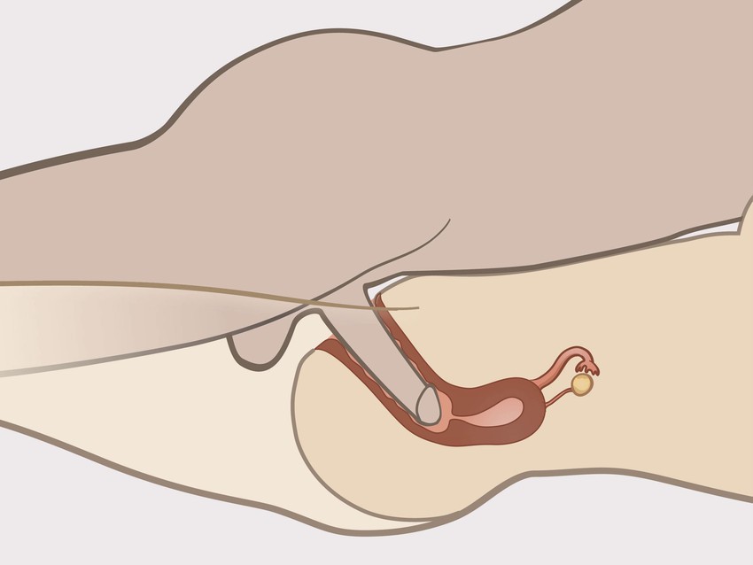 diepte van de vagina bij geslachtsgemeenschap diepte van de vagina bij seks